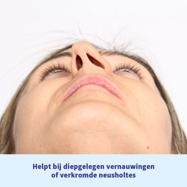 somnipax air - helpt bij vernauwingen of verkromde neusholtes